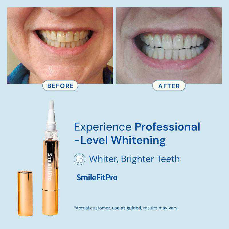 SmileFitPro™Teeth Whitening Essence