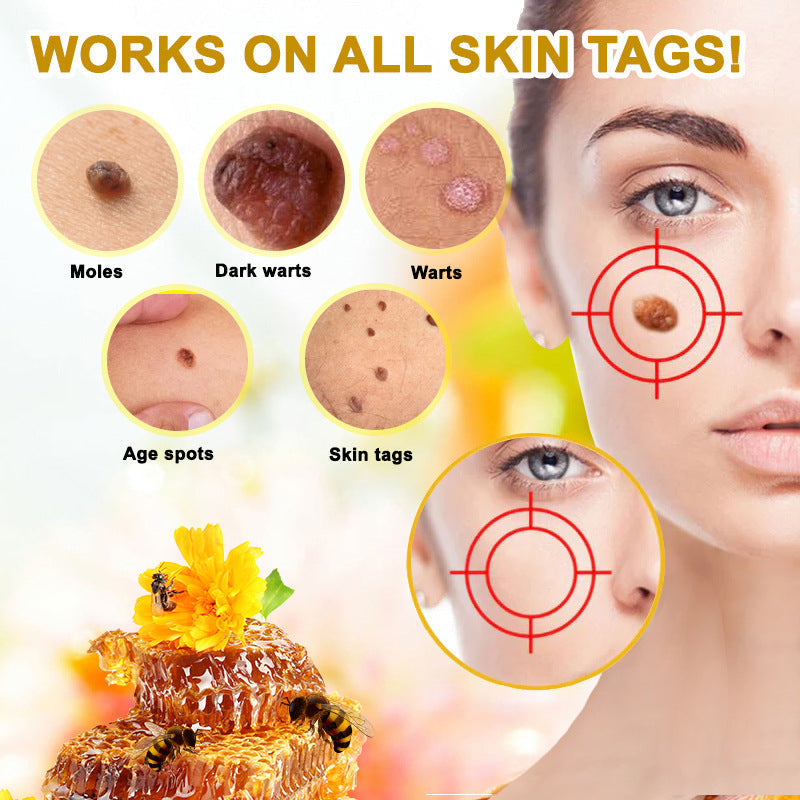 Slimoly™ Mole Remover – Fast, Gentle & Scar-Free Results