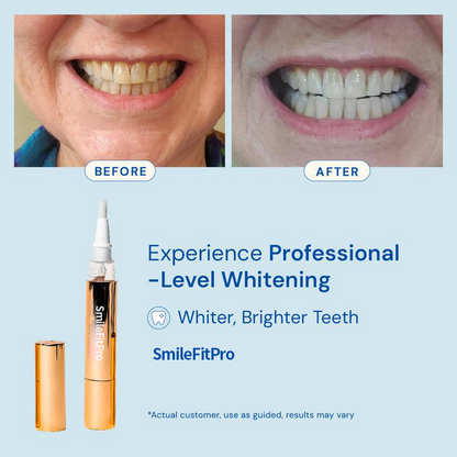 SmileFitPro™Teeth Whitening Essence