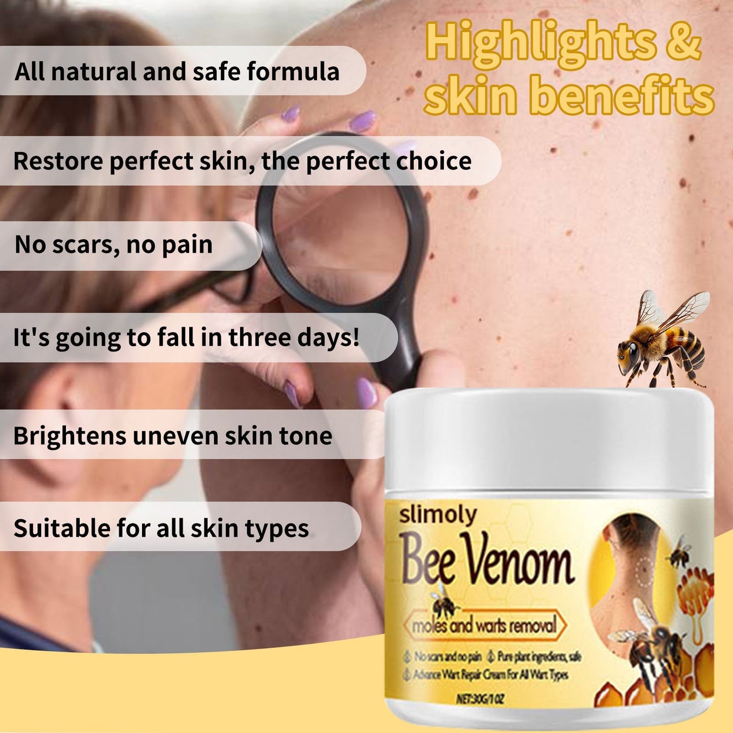 Slimoly™ Mole Remover – Fast, Gentle & Scar-Free Results