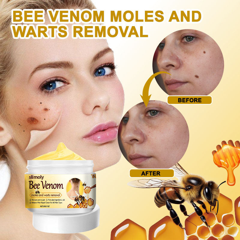Slimoly™ Mole Remover – Fast, Gentle & Scar-Free Results